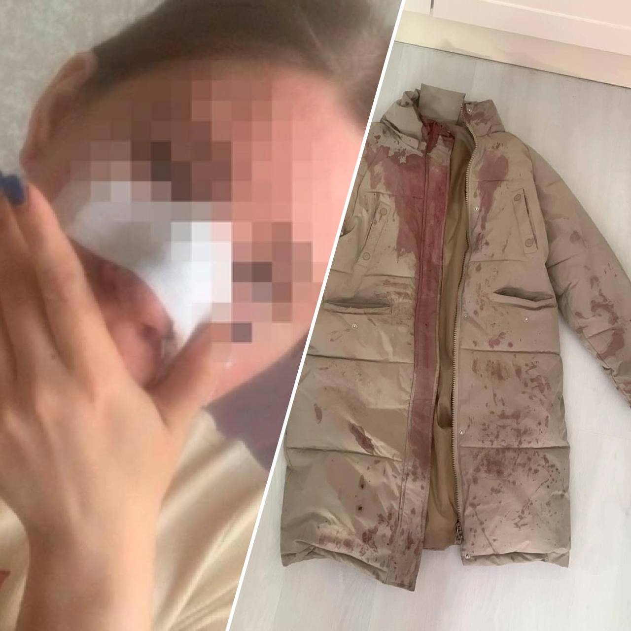 Что известно о мужчине, который напал на женщину из-за отказа познакомиться? Инцидент произошел вечером 19 октября на Фармана Салманова Что известно о мужчине, который напал на женщину из-за отказа познакомиться? Инцидент произошел вечером 19 октября на Фармана Салманова