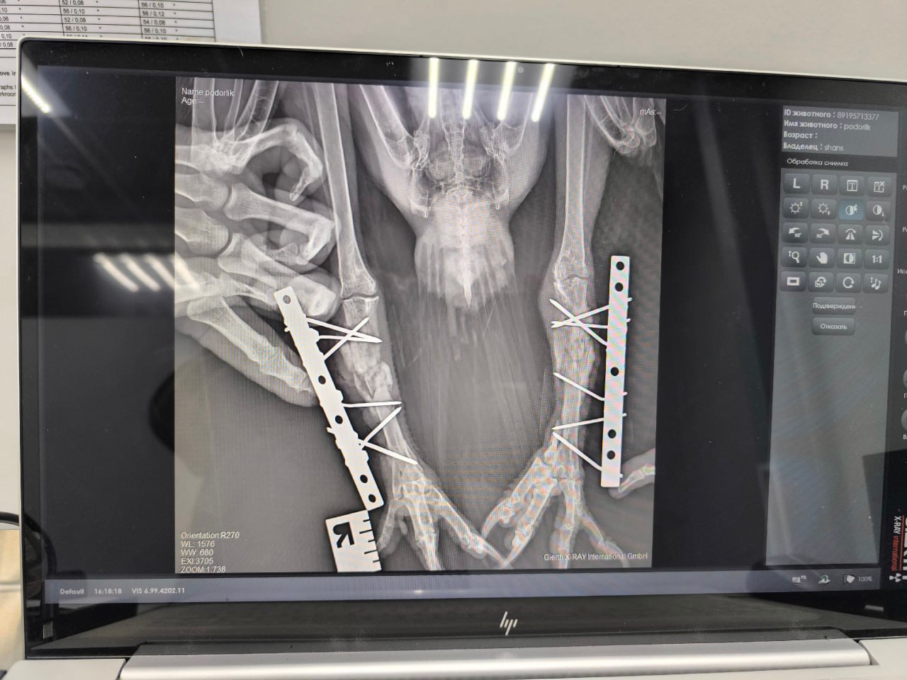 Краснокнижную птицу со сломанными лапами лечат аппаратом Илизарова в Кургане Краснокнижную птицу со сломанными лапами лечат аппаратом Илизарова в Кургане