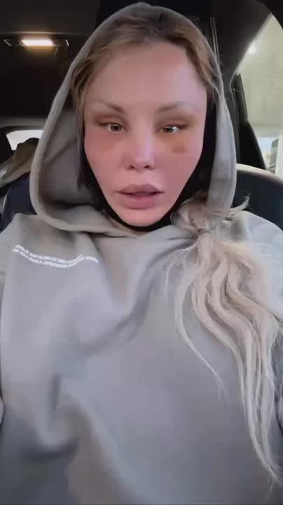 32-летняя ишимская порноактриса Любовь Бушуева легла на операционный стол ради красоты — результат на видео, которым она поделилась в соцсетях