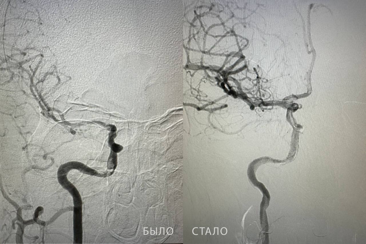 Тюменские врачи спасли молодого мужчину от инсульта! Тюменские врачи спасли молодого мужчину от инсульта!