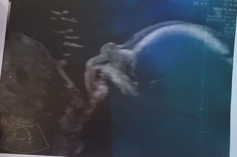 Молодая россиянка утопила собственного малыша, потому что была в "безвыходном положении" Молодая россиянка утопила собственного малыша, потому что была в "безвыходном положении"