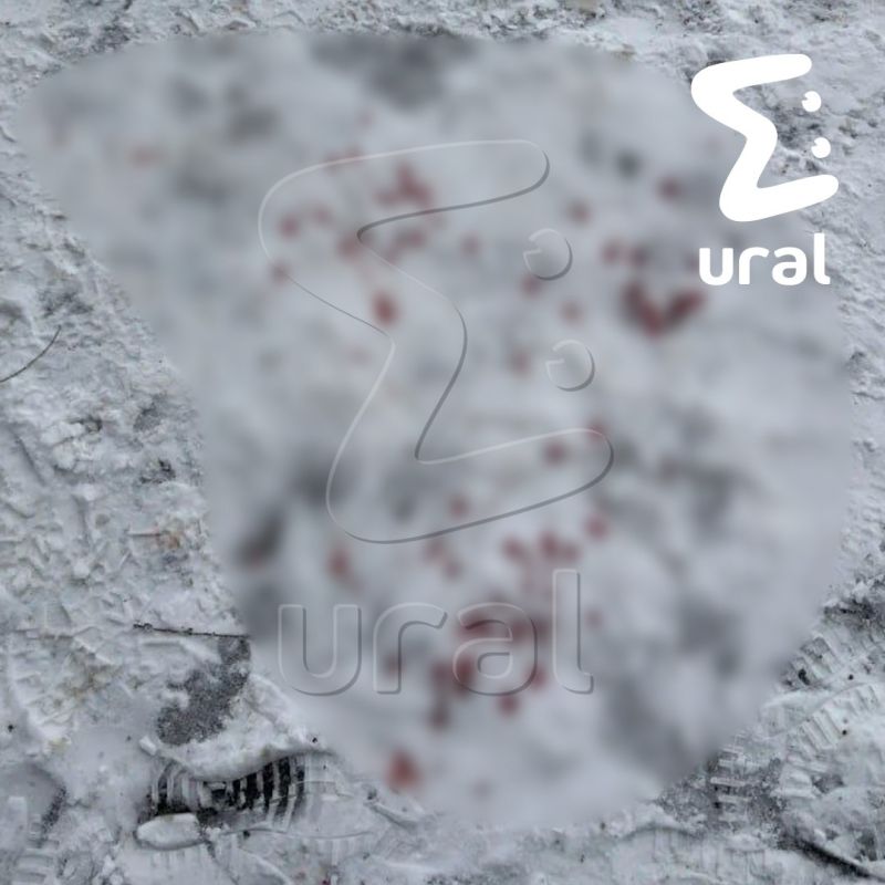 Подростку разорвало руку петардой в Тюмени