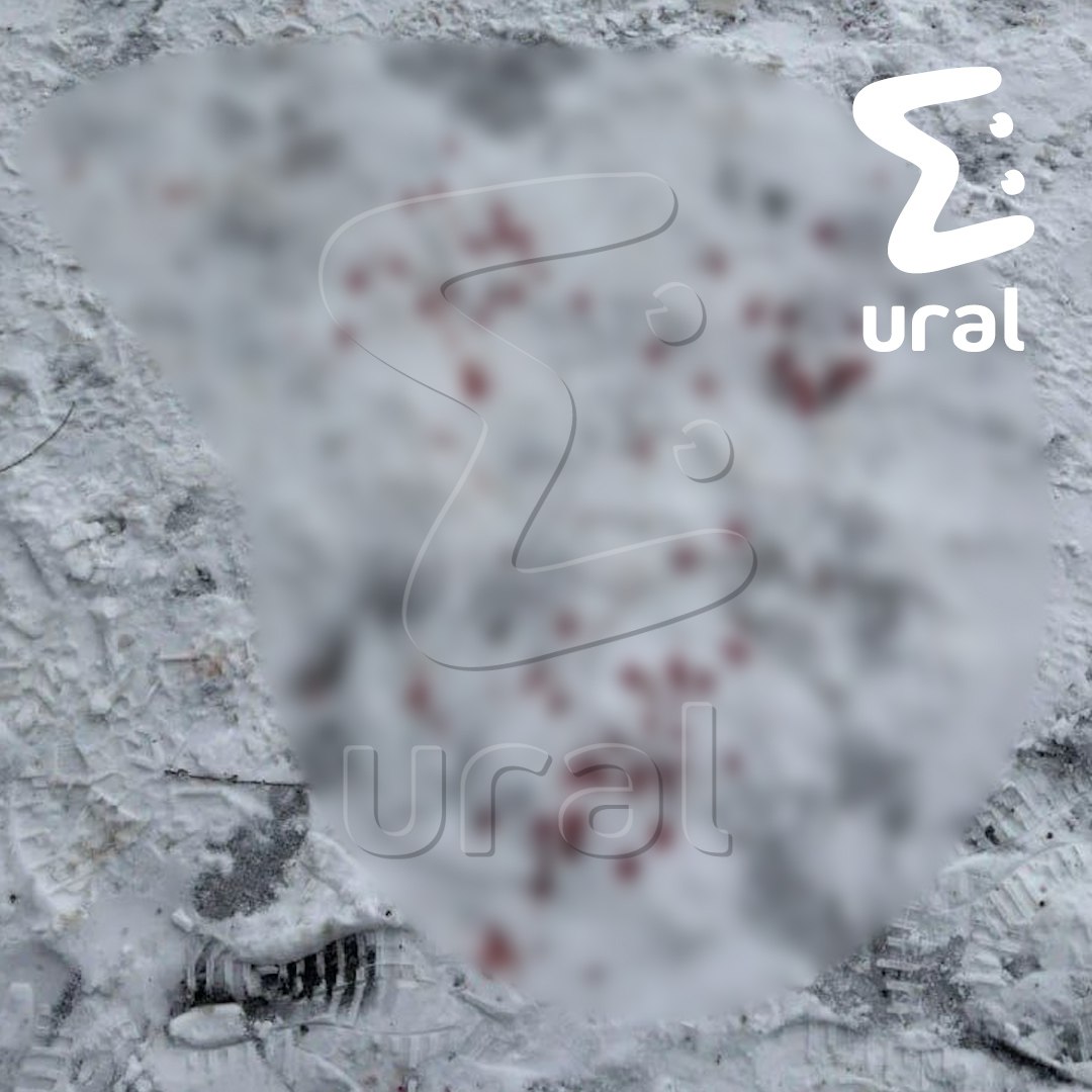 Подростку разорвало руку петардой в Тюмени