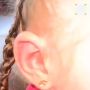 Энцефалитный клещ укусил 5-летнюю тюменку