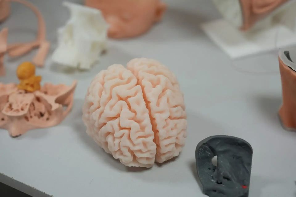 Тюменские школьники помогают нейрохирургам готовиться к сложным операциям Тюменские школьники помогают нейрохирургам готовиться к сложным операциям
