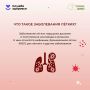 Лёгкие работают круглосуточно, обеспечивая организм кислородом