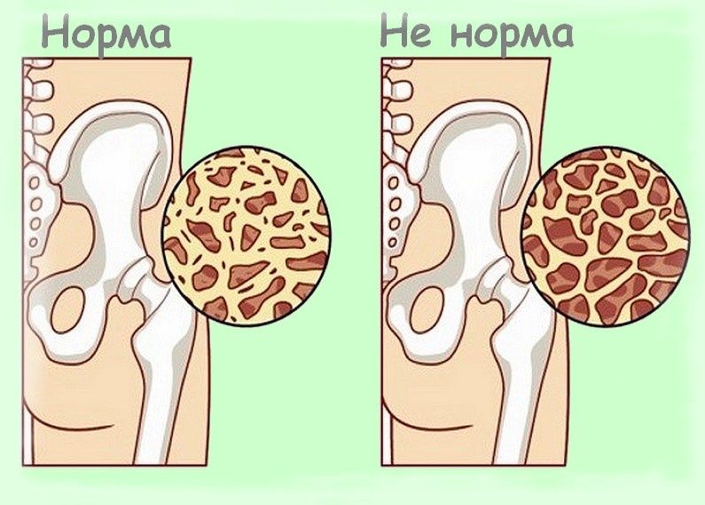 ������� ������� ������ ����� 55: ��� ������������� ���������� �����